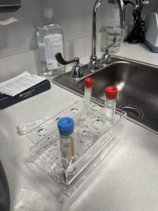 PRP procedure in Novi