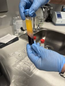 Platelet Rich Plasma in Novi
